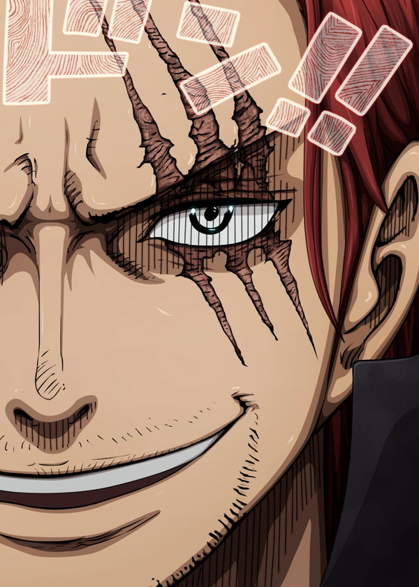 Shanks
